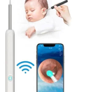 Smart Visual Ear Cleaner | منظف الأذن الذكي المزود بكاميرا عالية الدقة